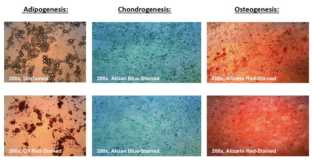 Adipogenesis, Chrondrogenesis, and Osteogenesis